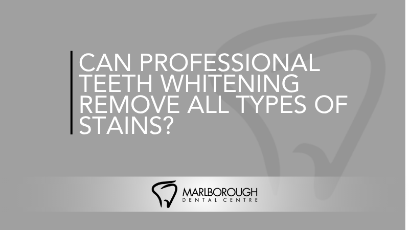 Can Professional Teeth Whitening Remove All Types of Stains? - Calgary Teeth Whitening